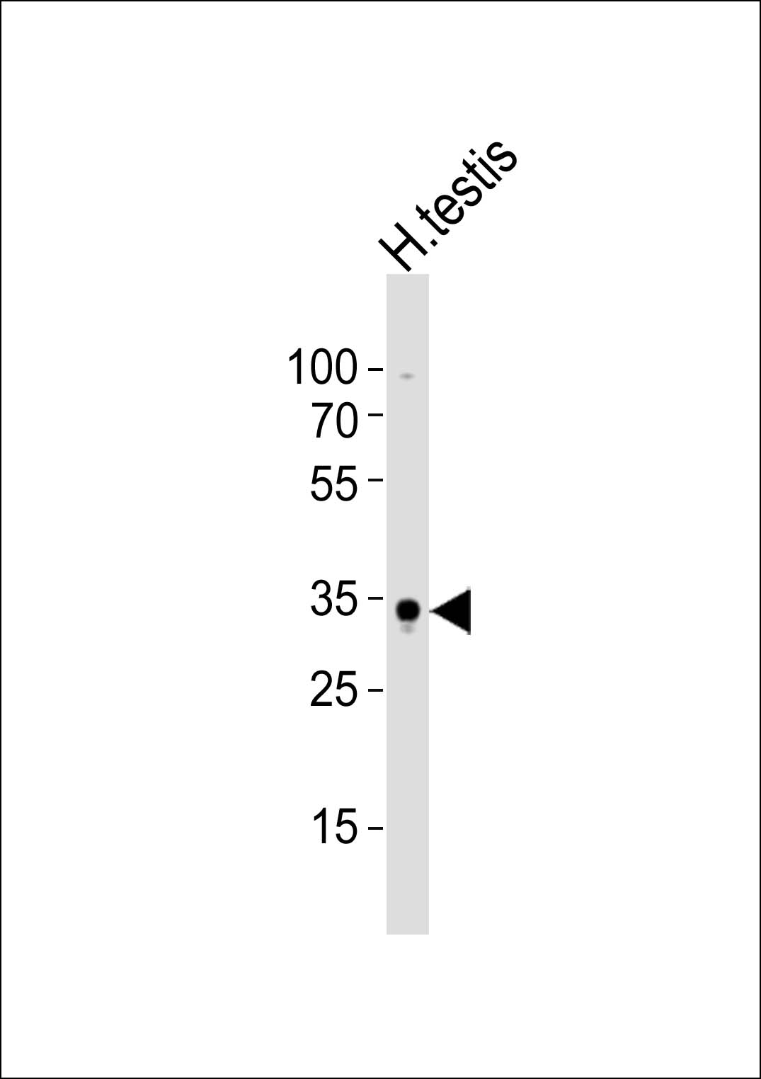 Rabbit Polyclonal Antibody to (Mouse) Sox15