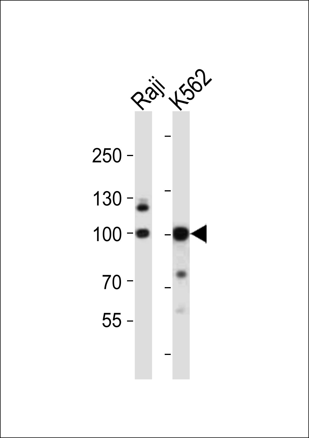 Rabbit Polyclonal Antibody to KDM1B (N-term)