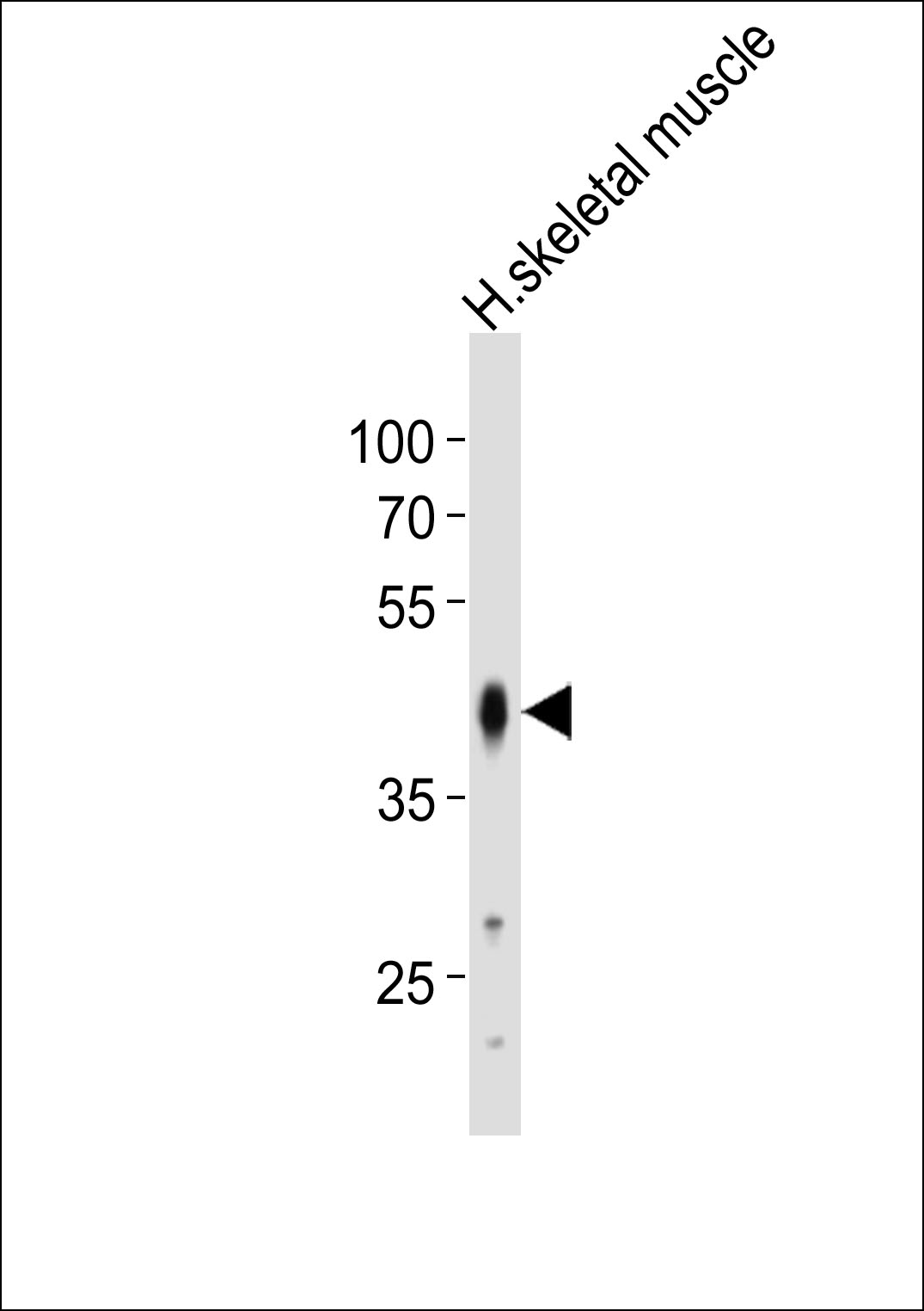 Rabbit Polyclonal Antibody to POU5F1B (N-term)