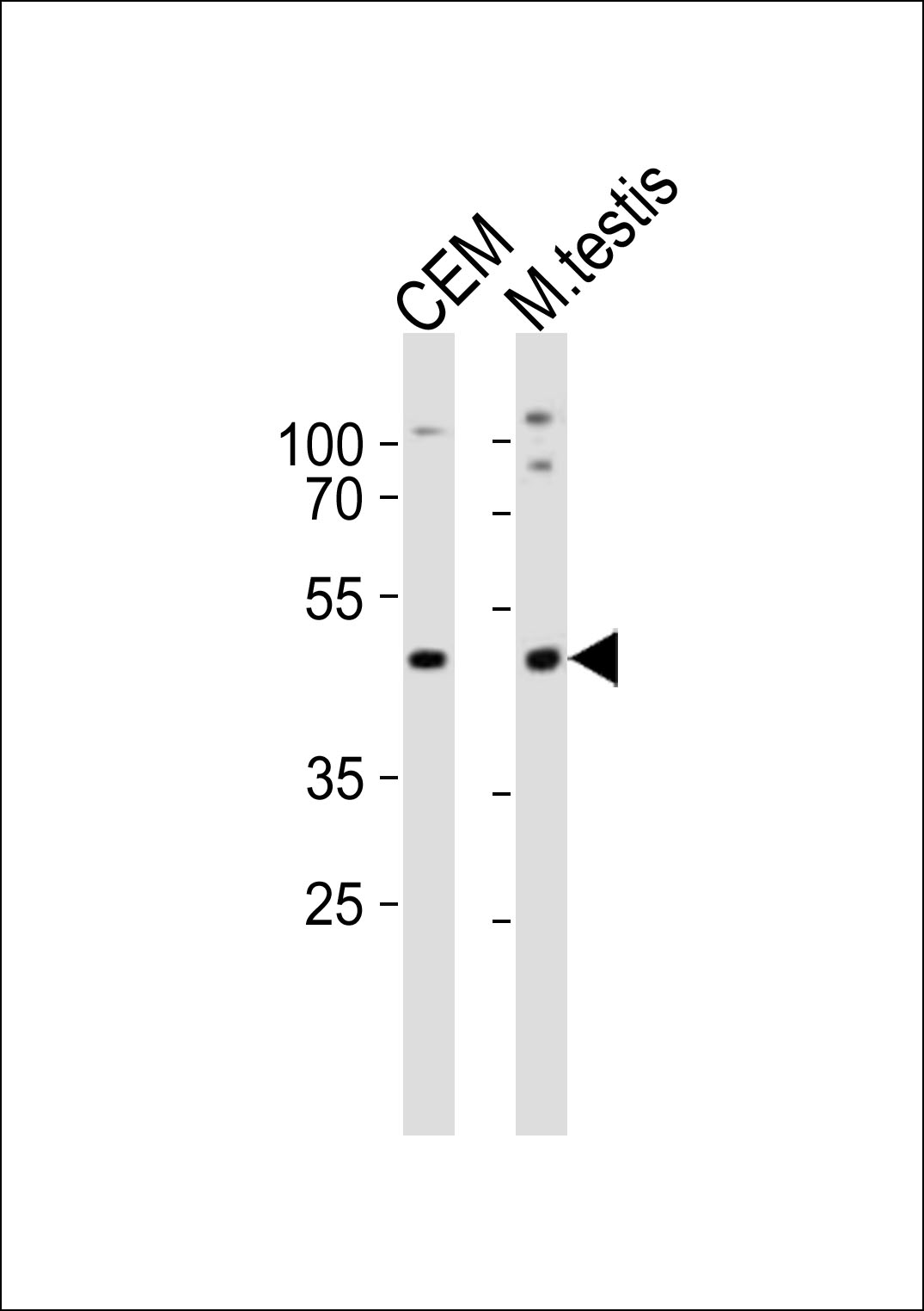 Rabbit Polyclonal Antibody to Mouse Lhx1