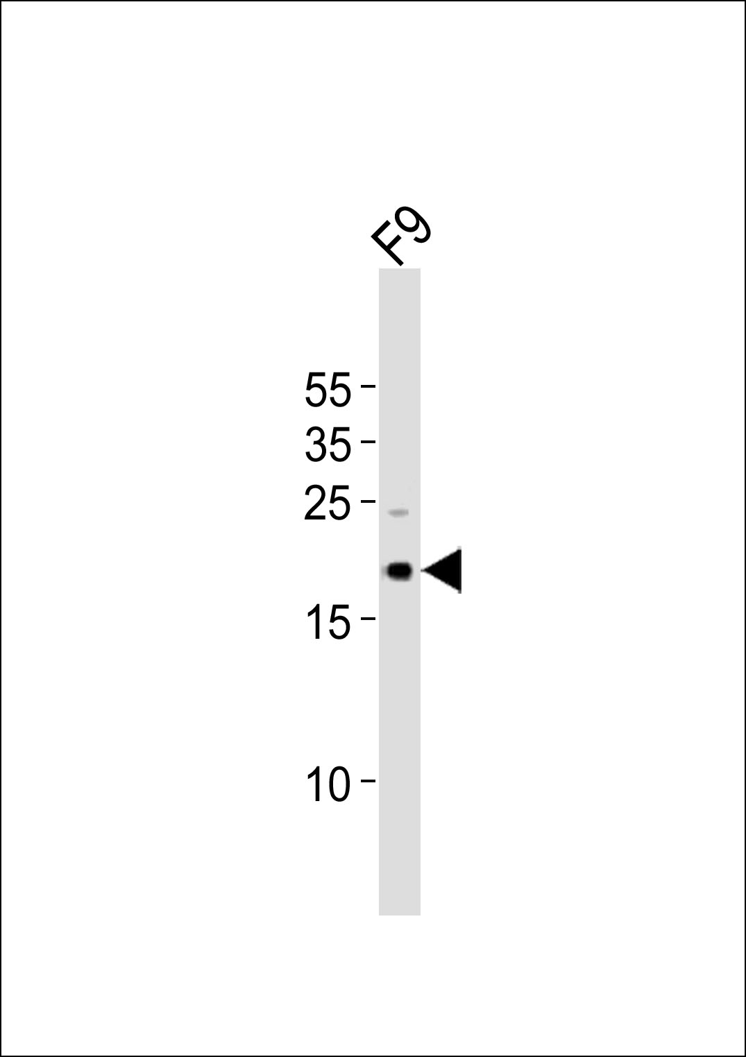 Rabbit Polyclonal Antibody to (Mouse) Tdgf1 (N-term)