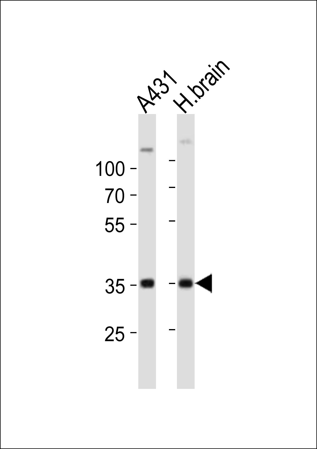 Rabbit Polyclonal Antibody to UTF1