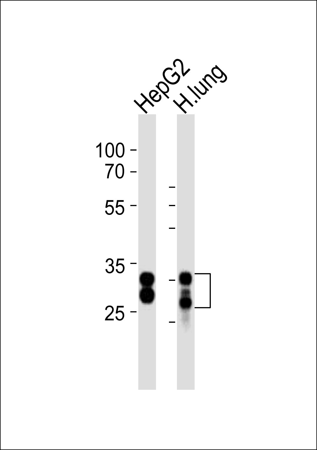 Rabbit Polyclonal Antibody to SULT1A1