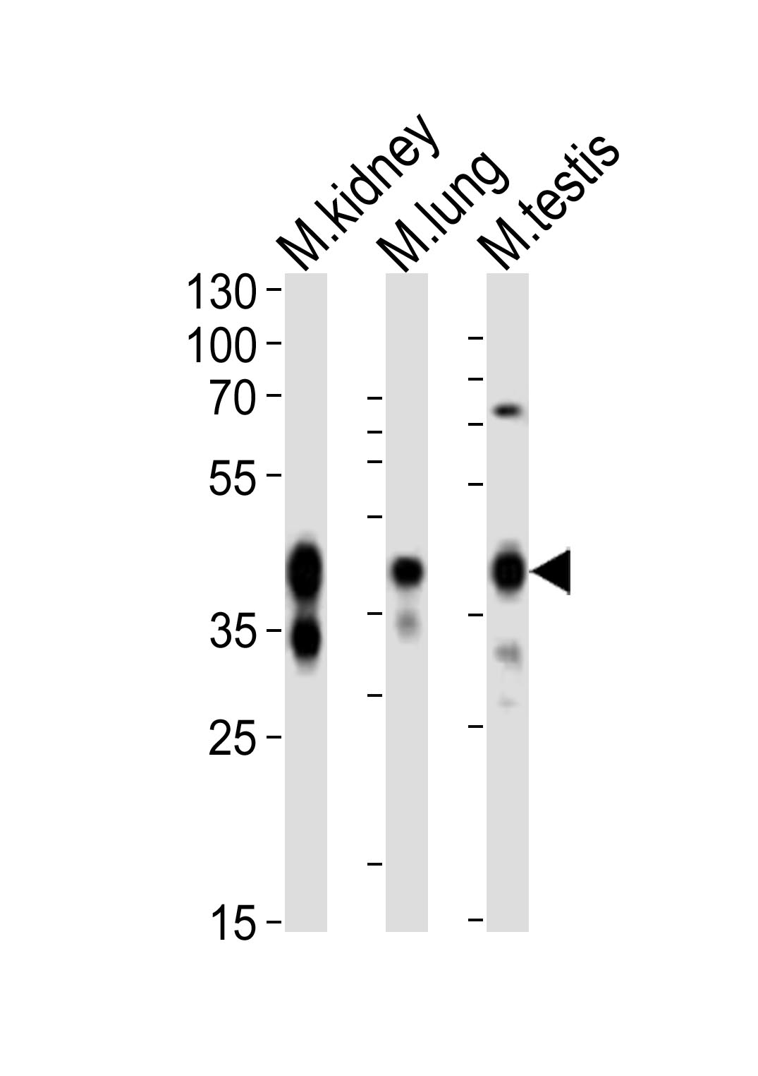 Rabbit Polyclonal Antibody to (Mouse) Epcam