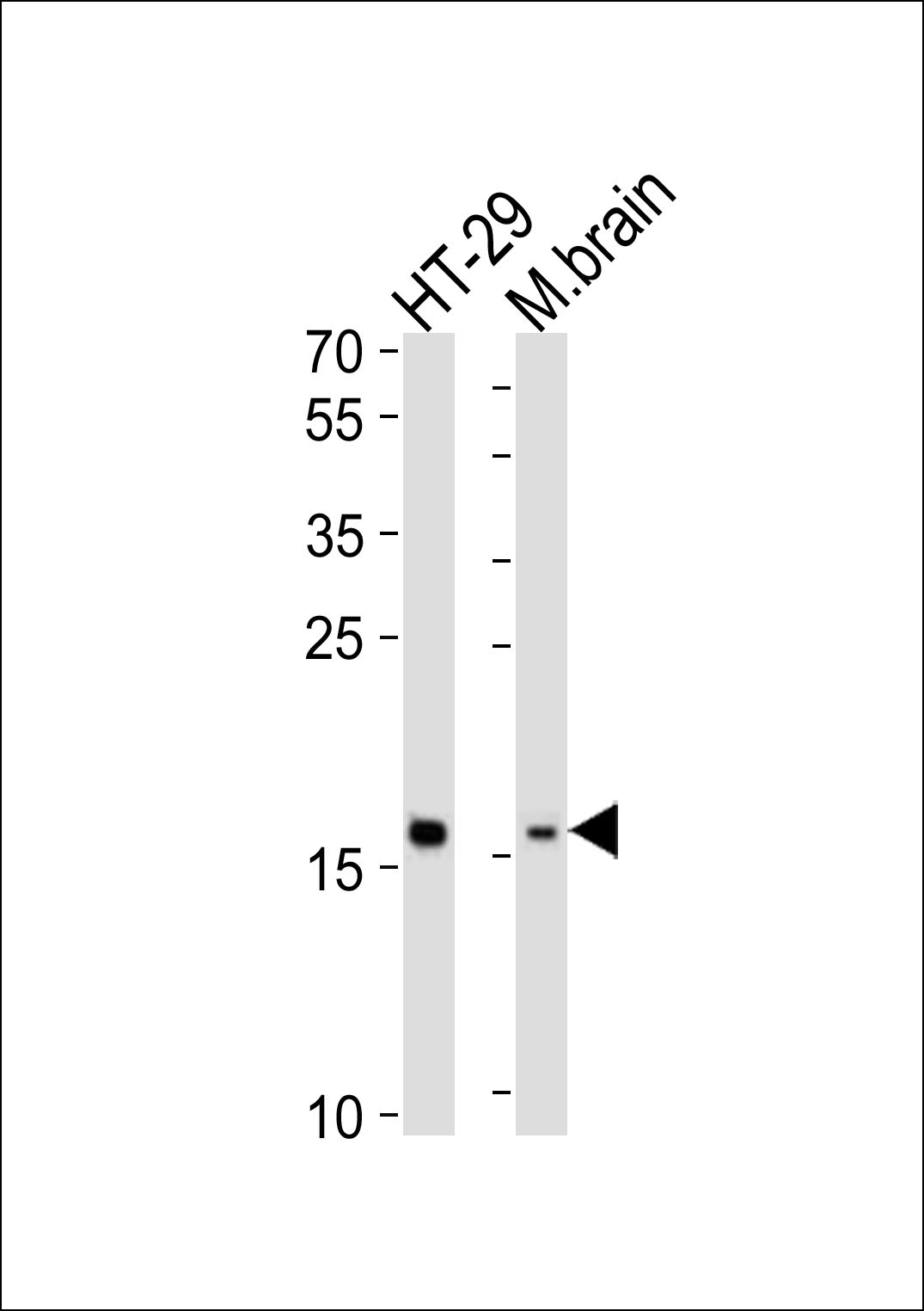 Rabbit Polyclonal Antibody to TMEM160  (N-term)