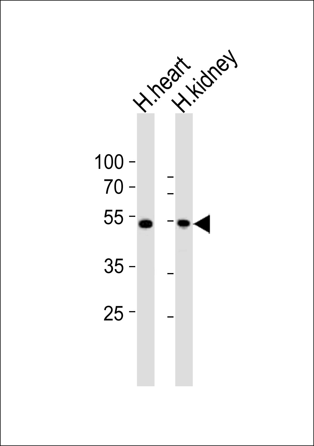 Rabbit Polyclonal Antibody to ST3GAL2 (N-term)