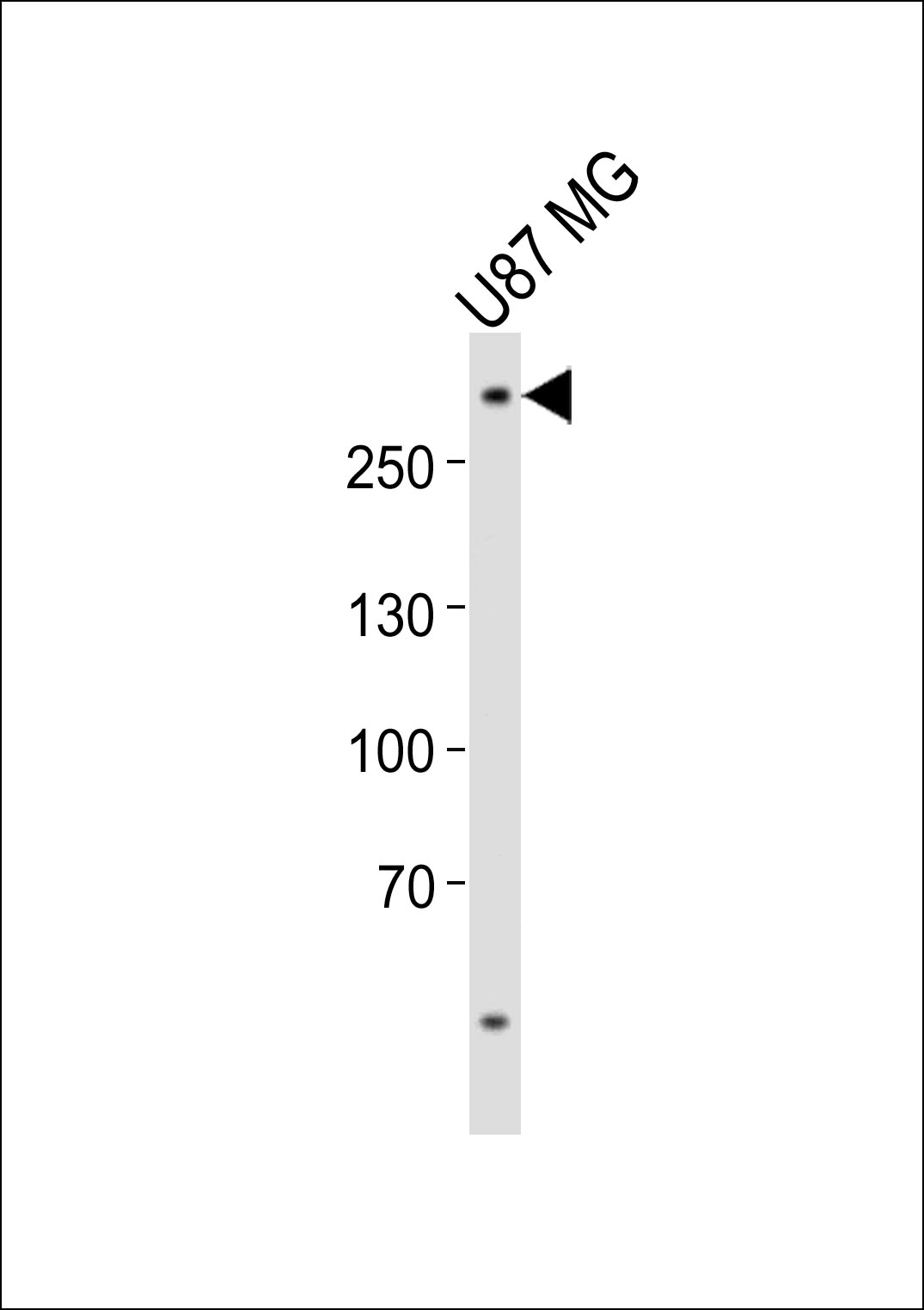 Rabbit Polyclonal Antibody to ABCA2