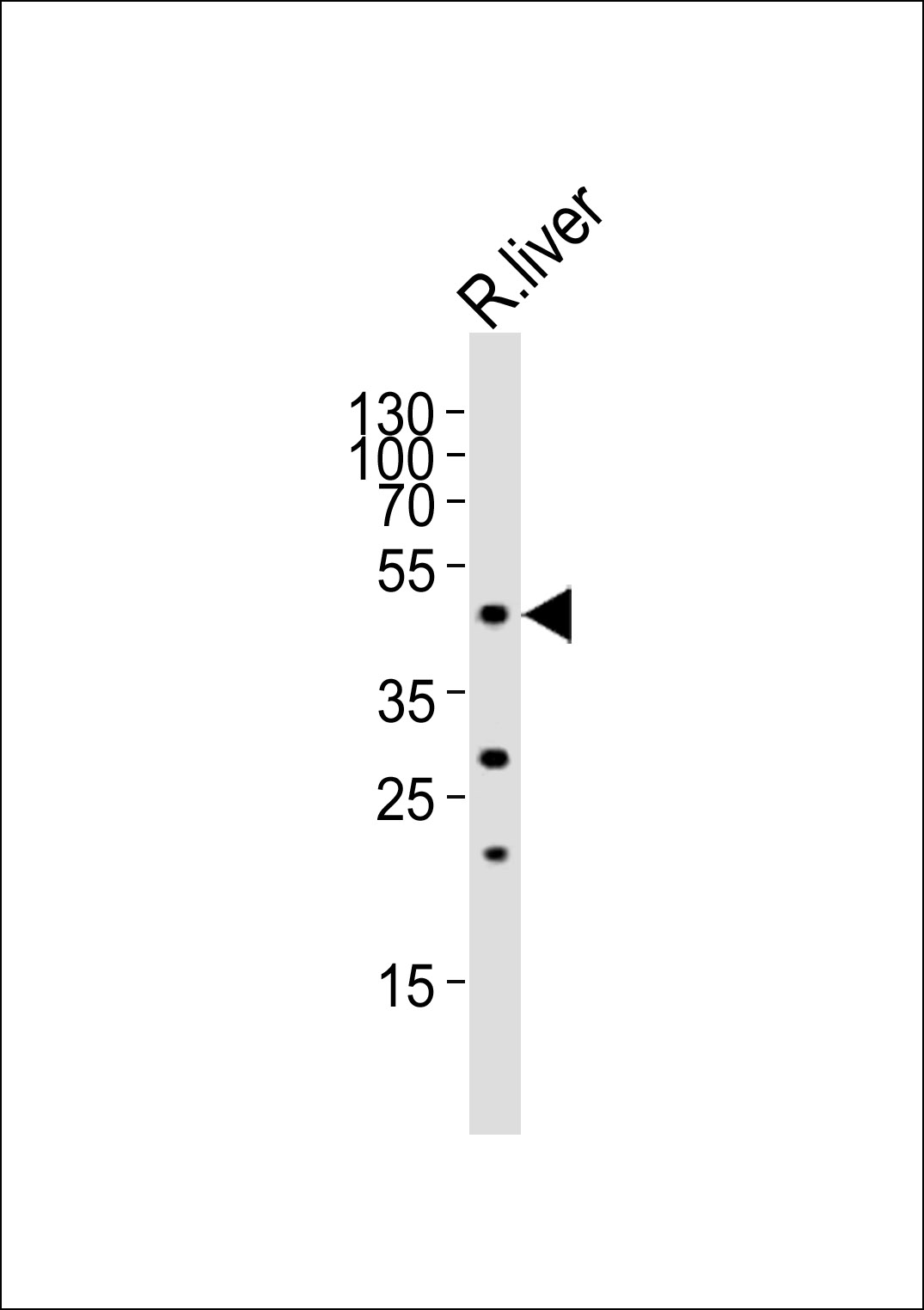 Rabbit Polyclonal Antibody to FOXA2