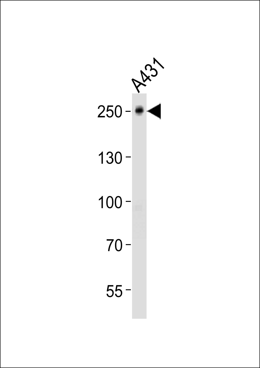 Rabbit Polyclonal Antibody to TJP1