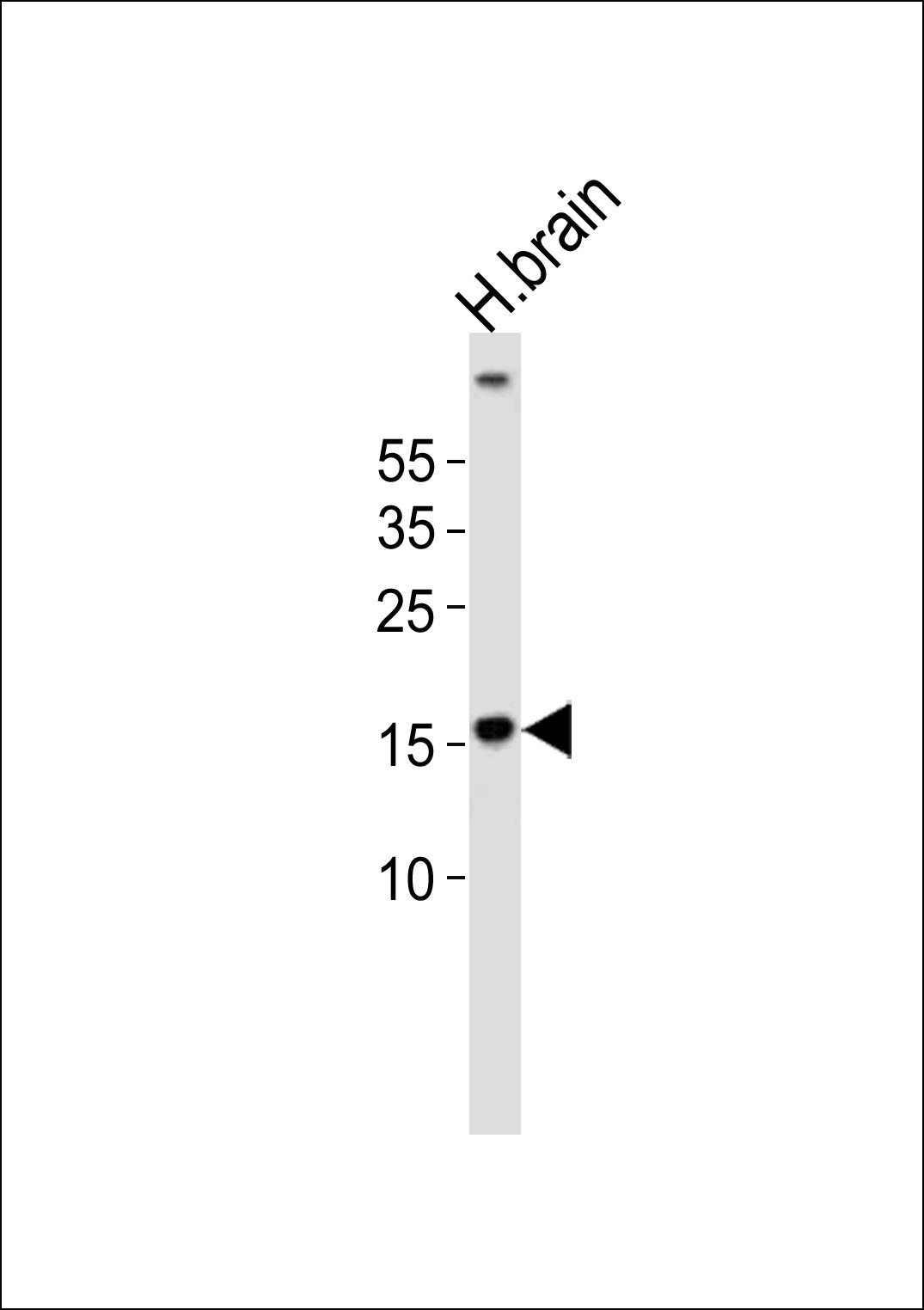 Rabbit Polyclonal Antibody to (DANRE)  map1lc3a (N-term)