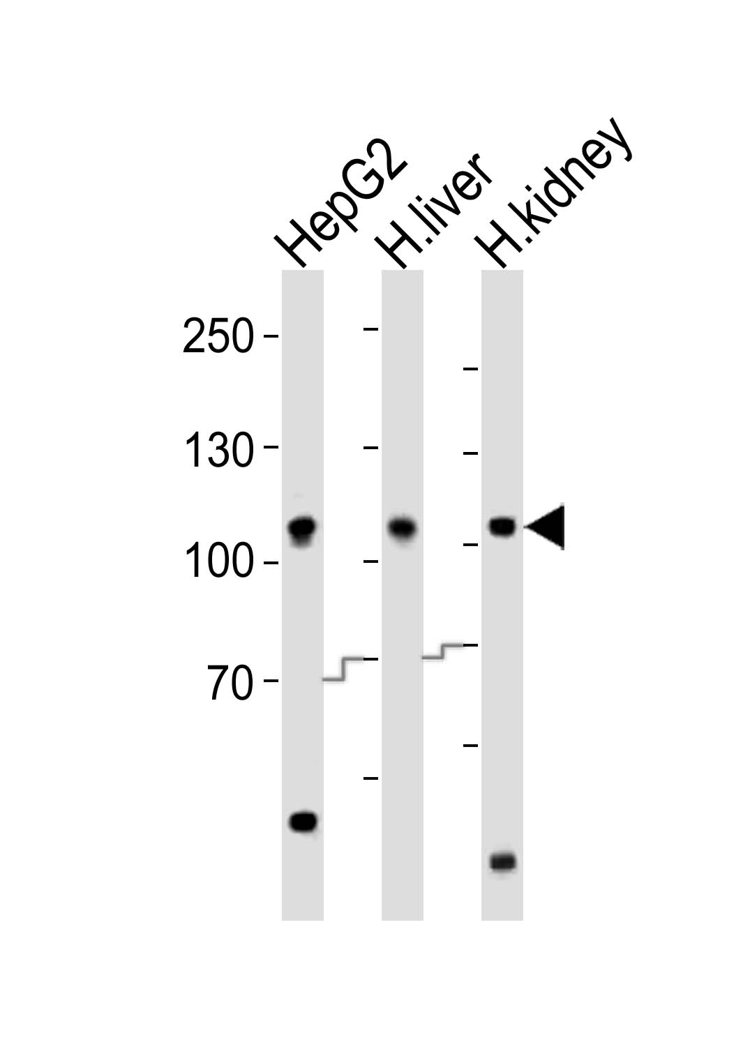 Rabbit Polyclonal Antibody to MTTP