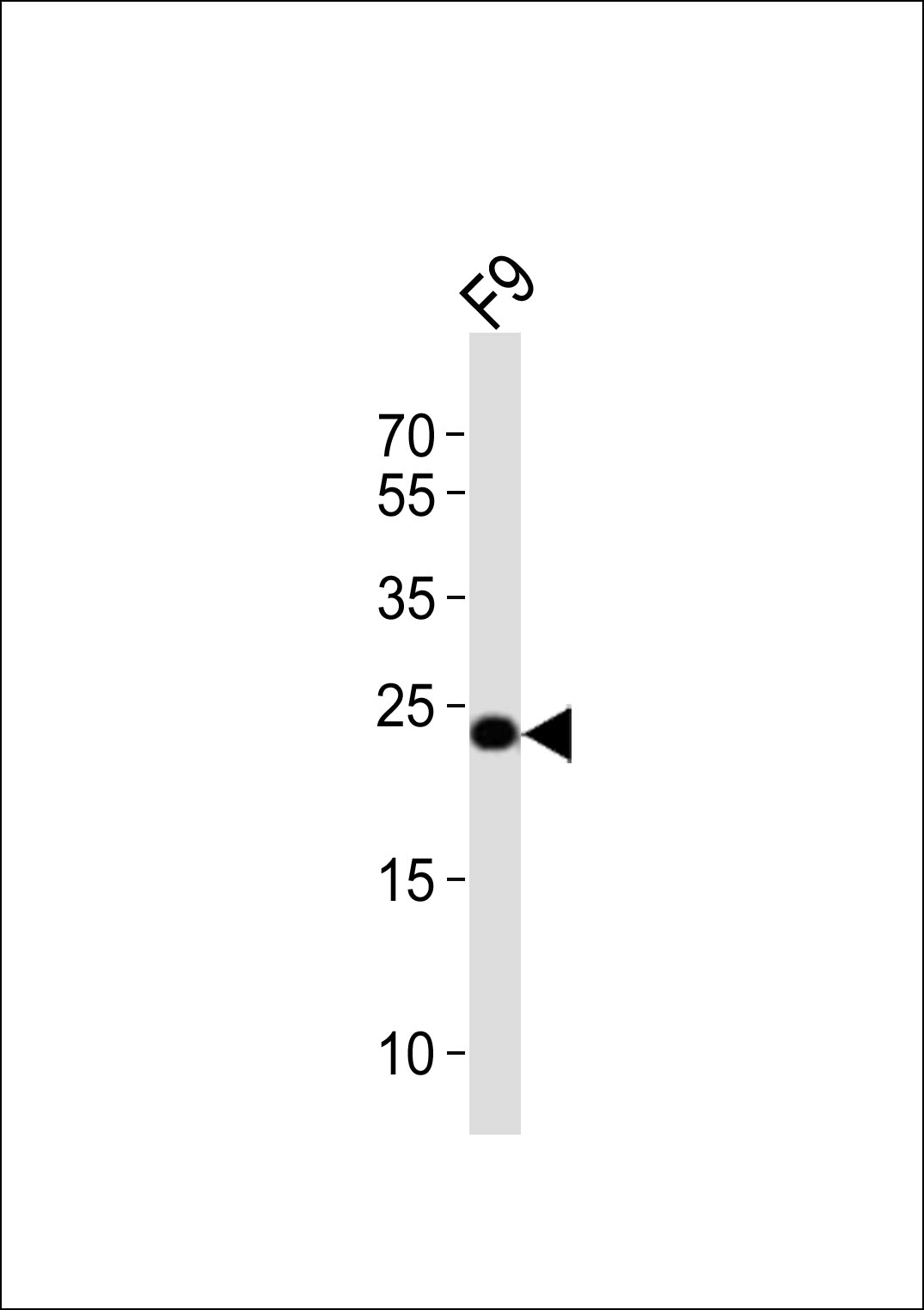 Rabbit Polyclonal Antibody to (Mouse) Eras (N-term)