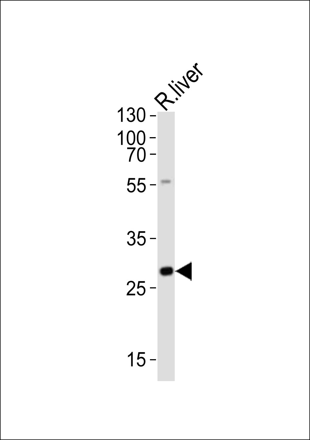 Rabbit Polyclonal Antibody to Mouse Olig3