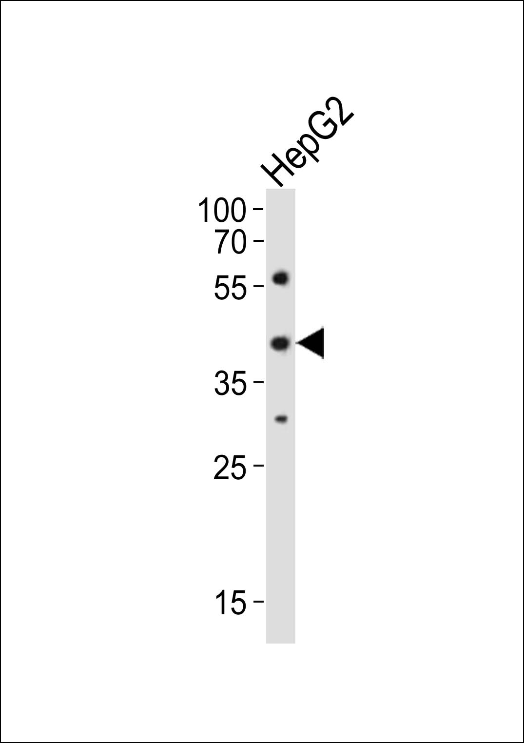 Rabbit Polyclonal Antibody to Mouse Lhx1