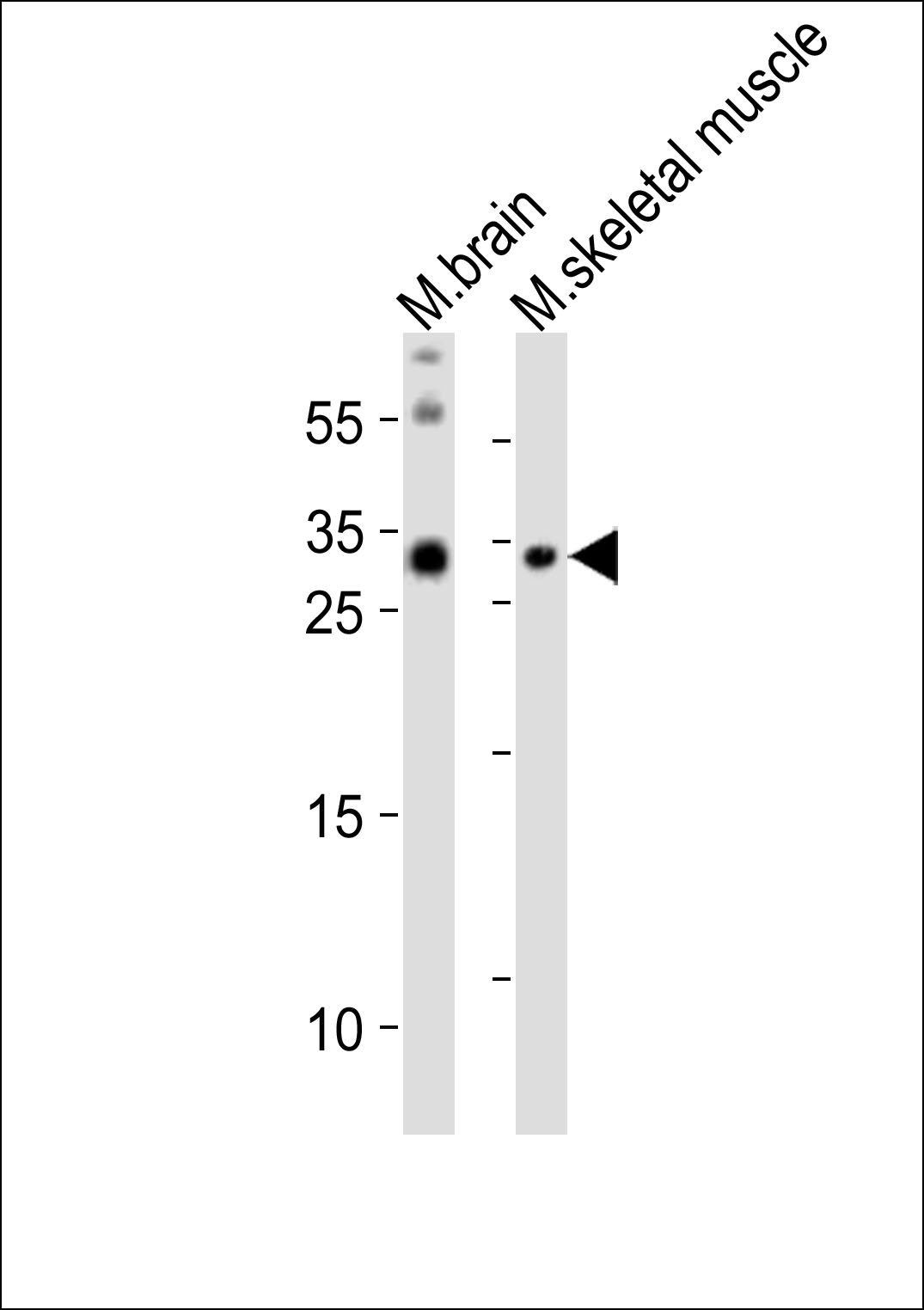 Rabbit Polyclonal Antibody to OLIG3 (N-term)
