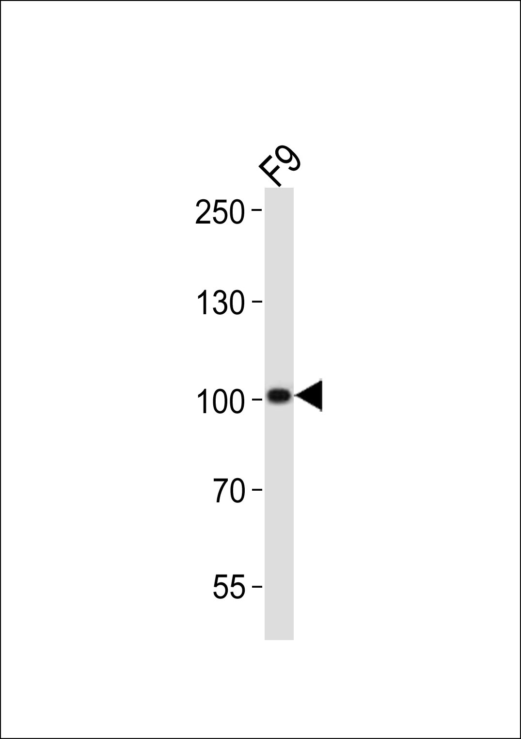 Rabbit Polyclonal Antibody to (Mouse) Suz12