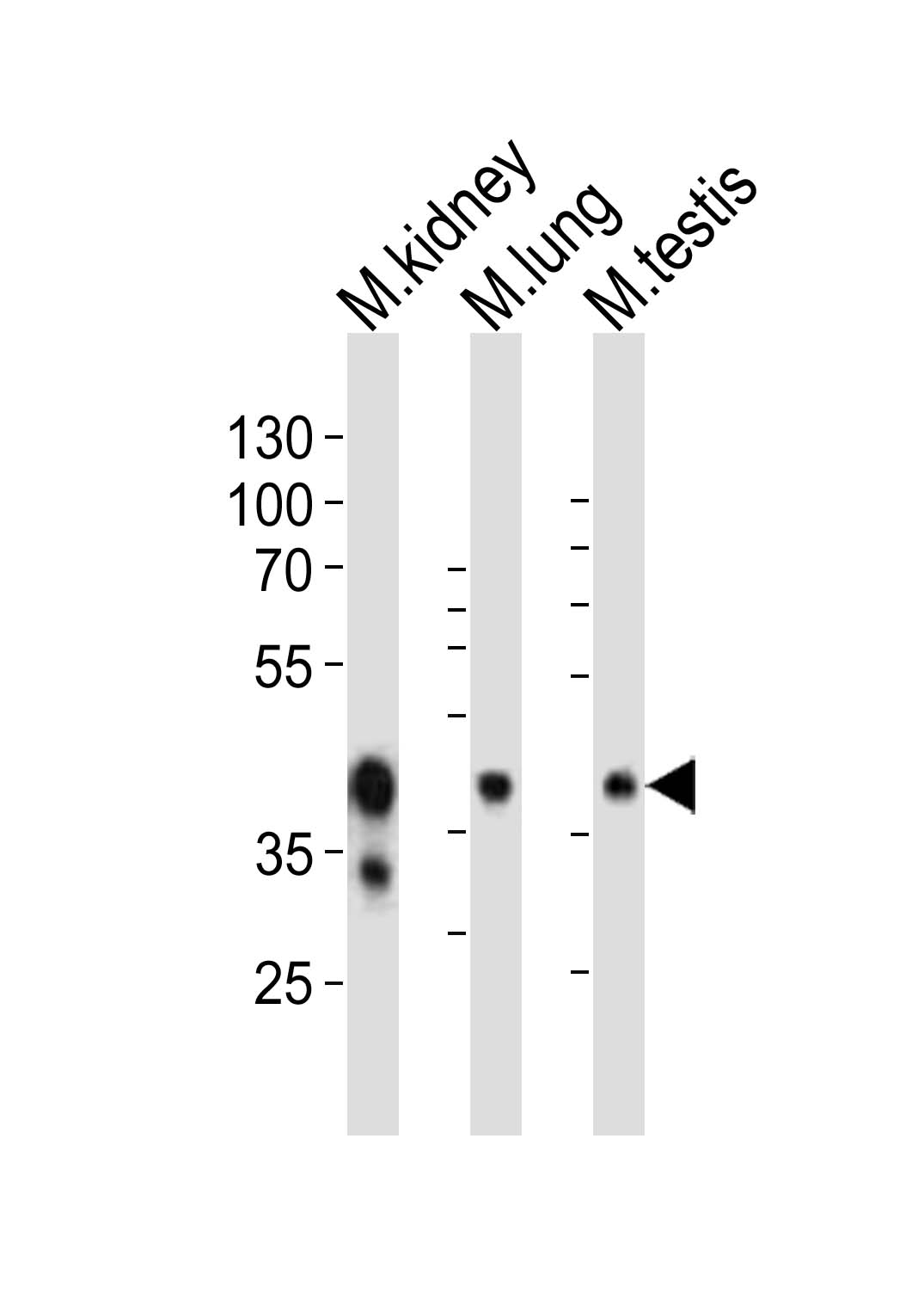 Rabbit Polyclonal Antibody to (Mouse) Epcam