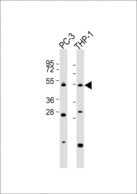 Rabbit Polyclonal Antibody to CPA5