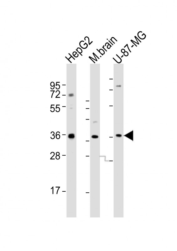 Rabbit Polyclonal Antibody to CRYZ