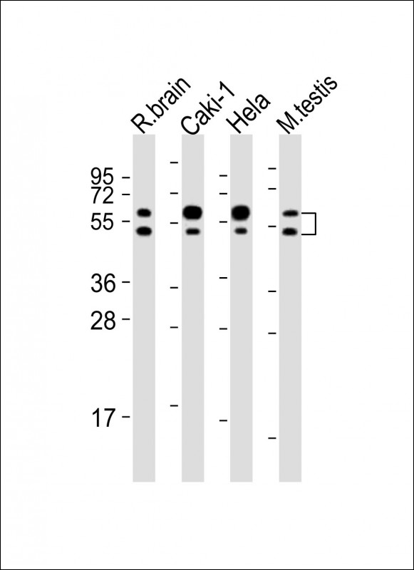 Rabbit Polyclonal Antibody to CDKL3 (N-Term)