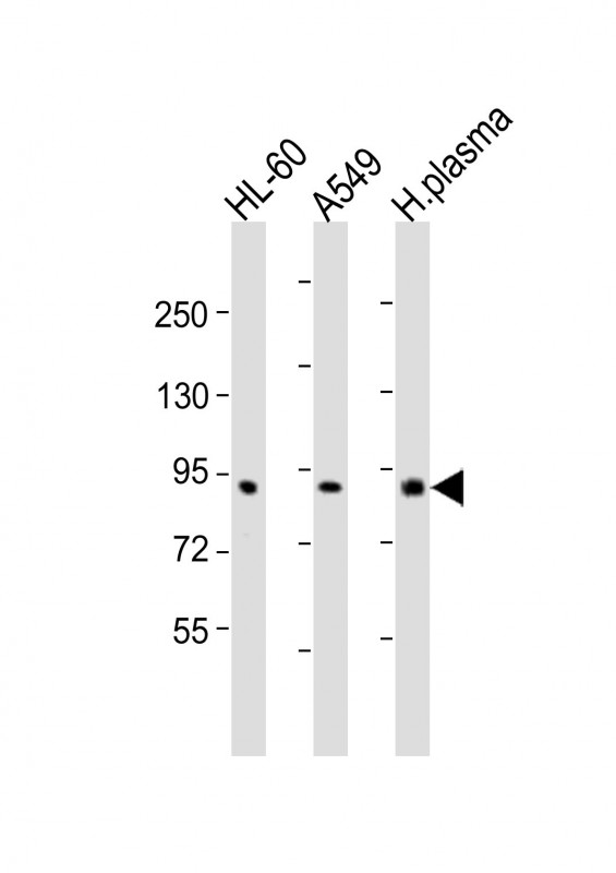 Rabbit Polyclonal Antibody to F2 (N-Term)