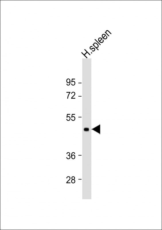 Rabbit Polyclonal Antibody to DPEP2 (N-Term)