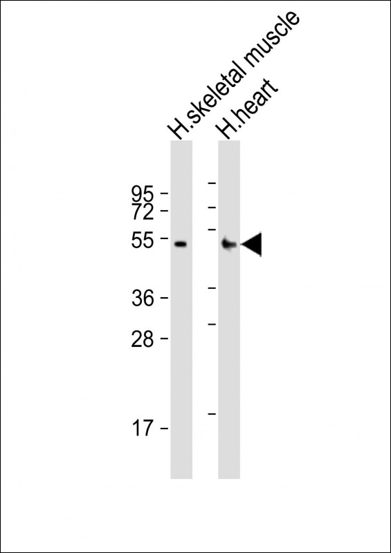 Rabbit Polyclonal Antibody to RHBDL1