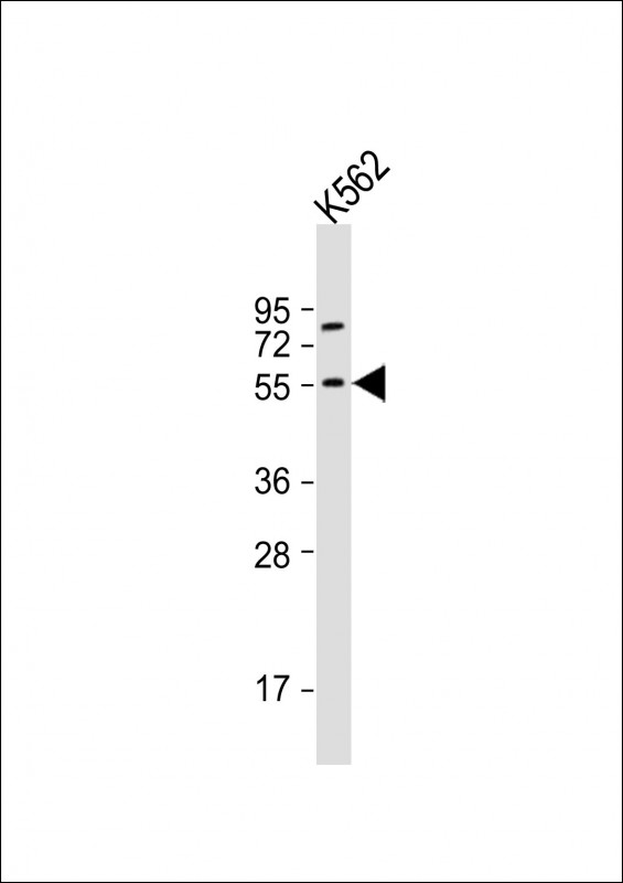 Rabbit Polyclonal Antibody to NAGS
