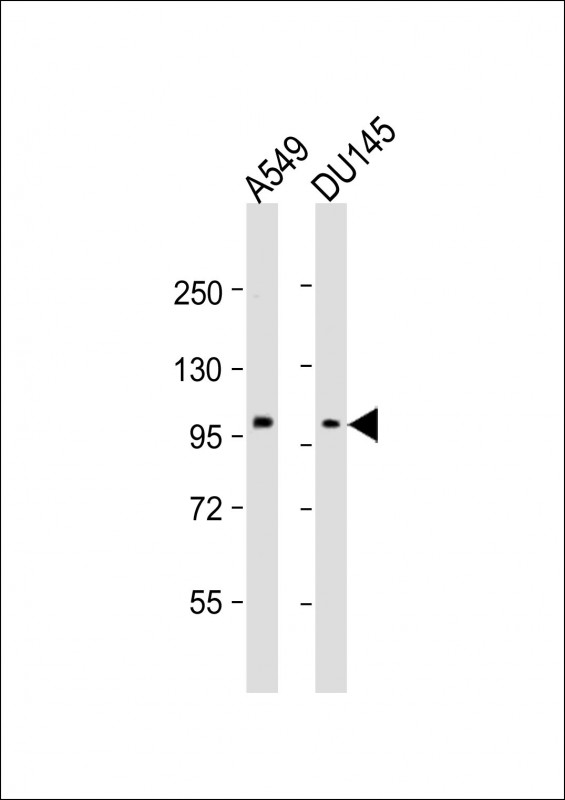 Rabbit Polyclonal Antibody to SEMA4B