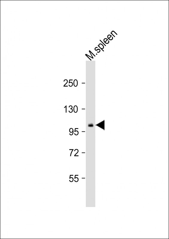 Rabbit Polyclonal Antibody to Mouse Ptk2b (P851)