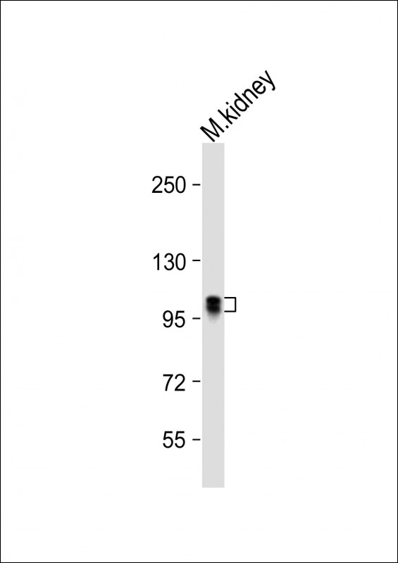 Rabbit Polyclonal Antibody to Mouse Insr (P1325)