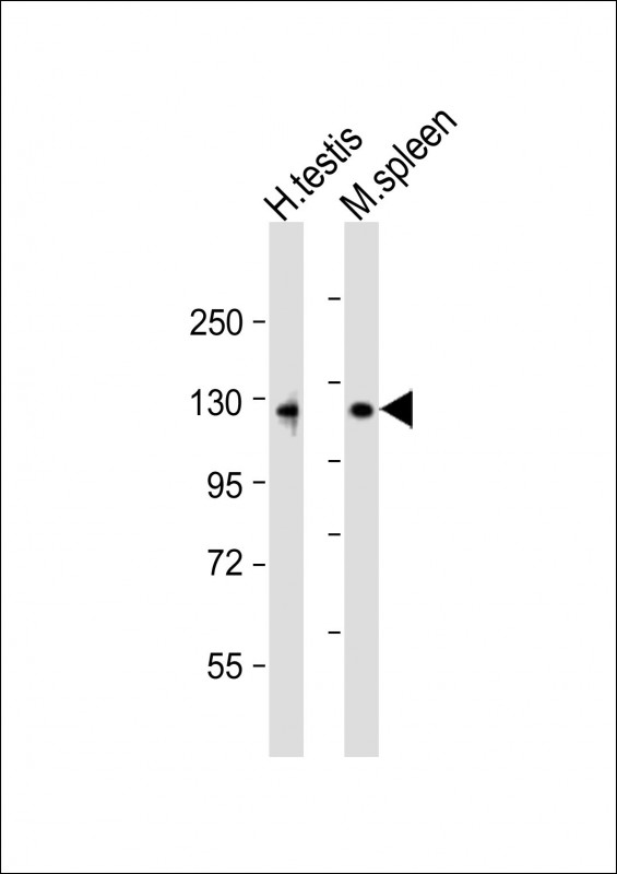Rabbit Polyclonal Antibody to PPP6R1