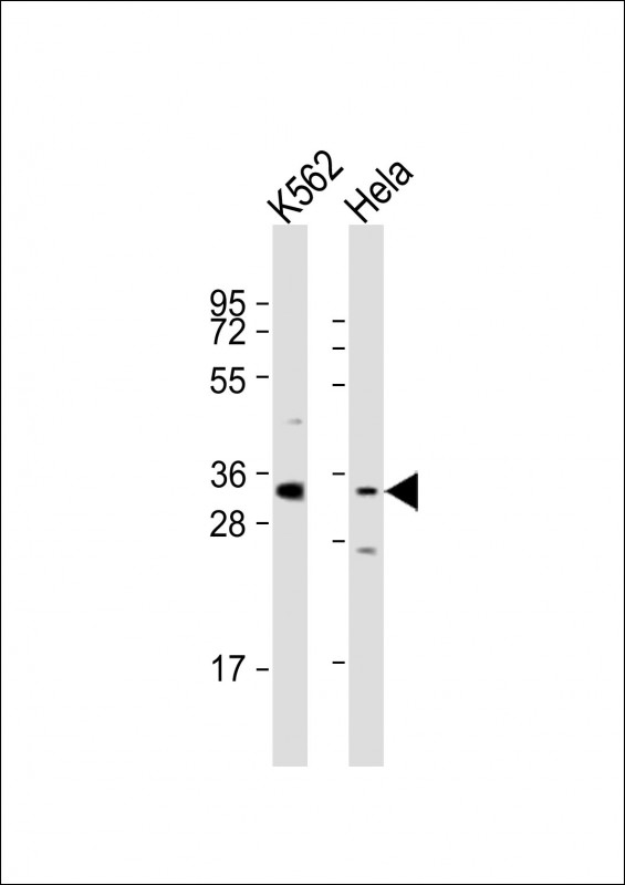 Rabbit Polyclonal Antibody to PRSS21 (N-Term)