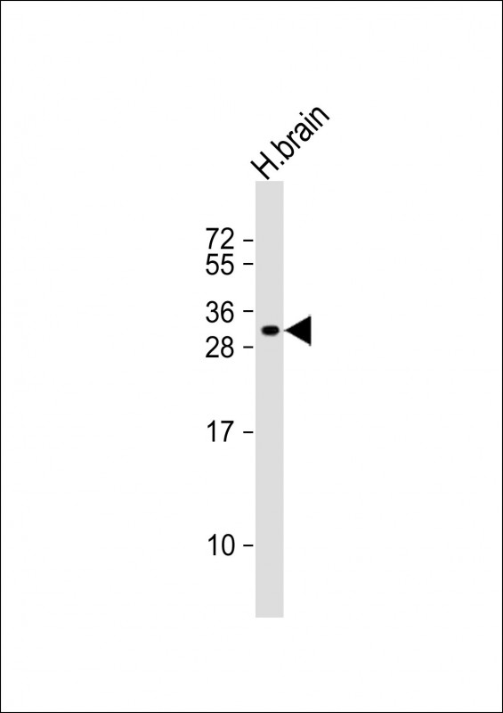 Rabbit Polyclonal Antibody to CALY