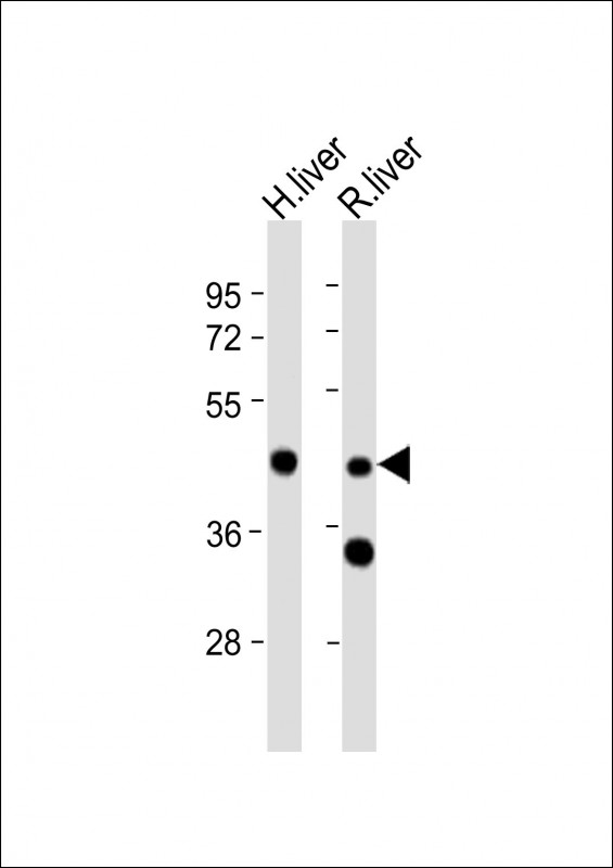 Rabbit Polyclonal Antibody to WIPF3 (N-term)