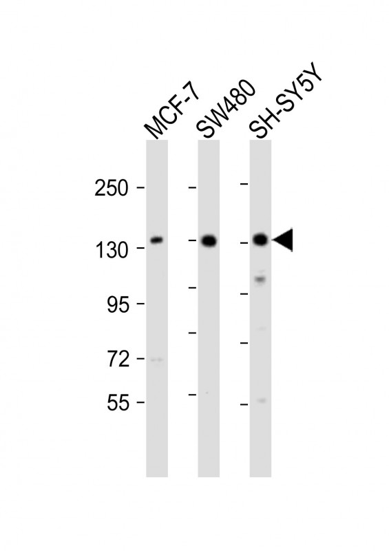 Rabbit Polyclonal Antibody to SRGAP2