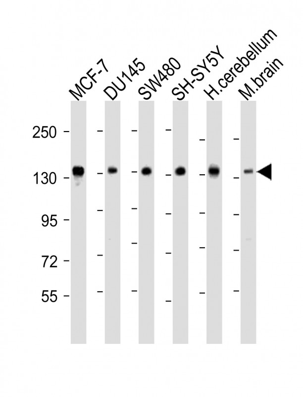Rabbit Polyclonal Antibody to SRGAP2