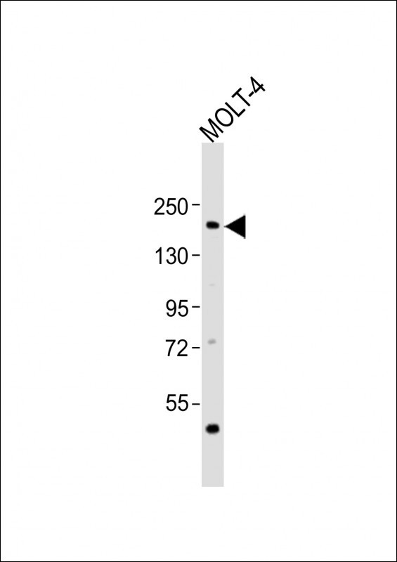 Rabbit Polyclonal Antibody to SOS1