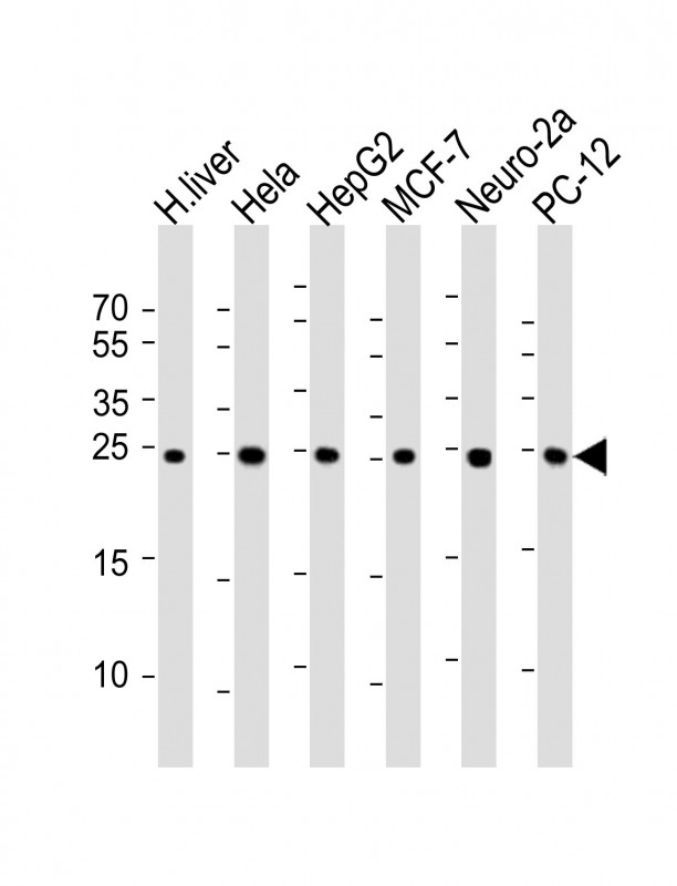 Mouse Monoclonal Antibody to PSMA5