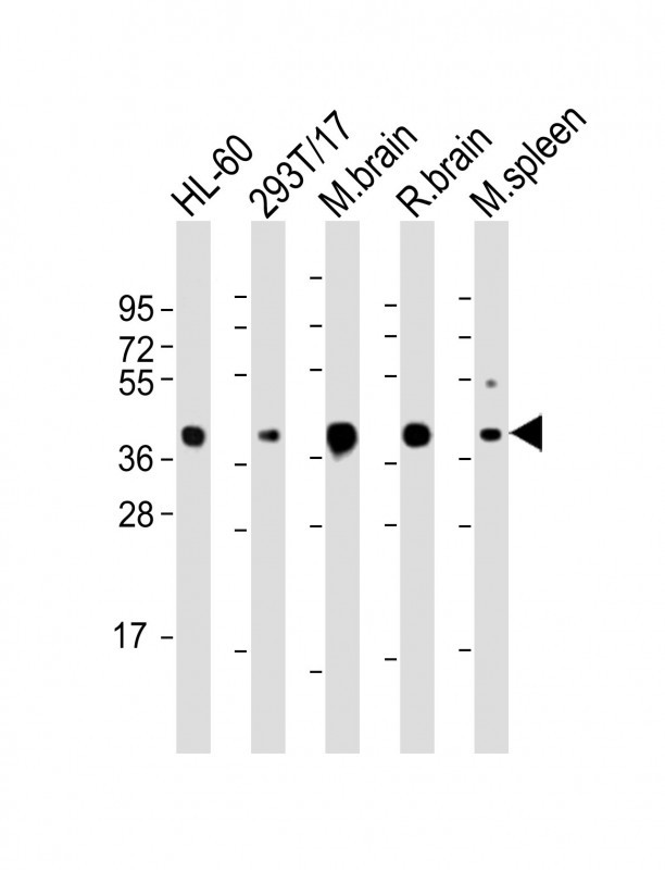 Mouse Monoclonal Antibody to ALDOC