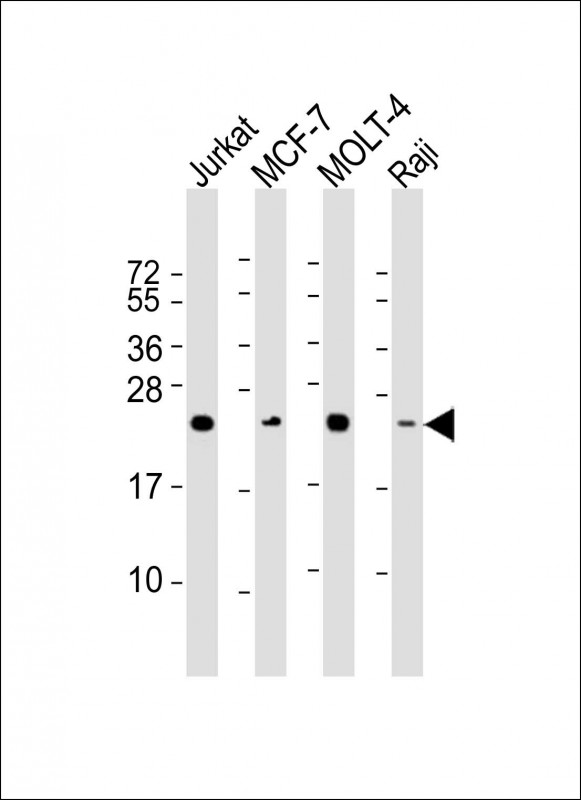 Mouse Monoclonal Antibody to MGMT