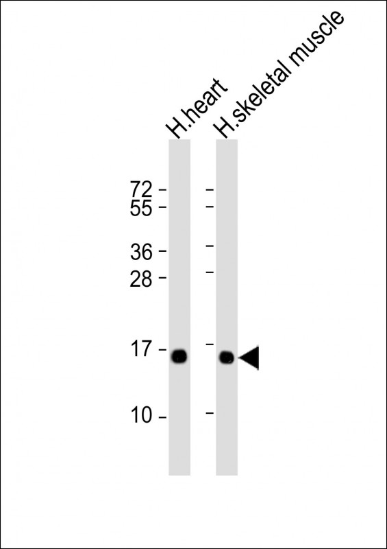 Mouse Monoclonal Antibody to TUSC2