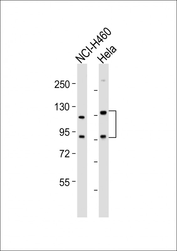 Rabbit Polyclonal Antibody to SLCO1B3