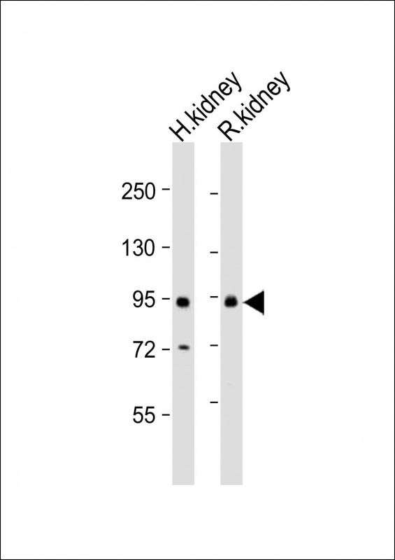 Rabbit Polyclonal Antibody to SLC26A4