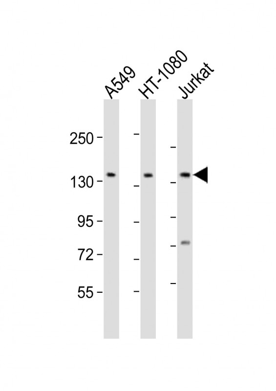 Rabbit Polyclonal Antibody to FMN1