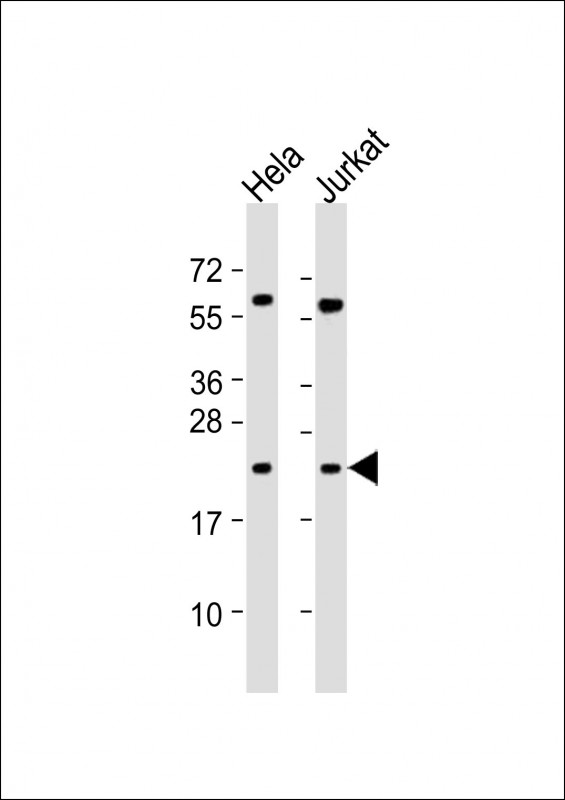 Rabbit Polyclonal Antibody to PSMB6