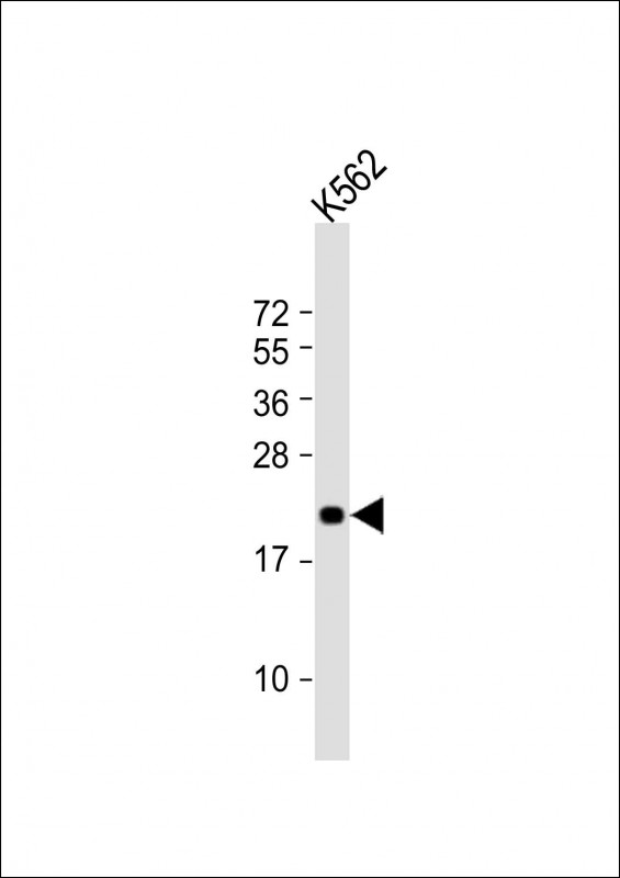 Rabbit Polyclonal Antibody to FEV (N-Term)