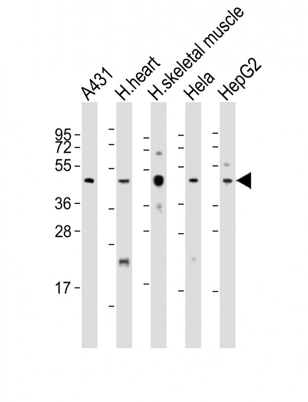 Rabbit Polyclonal Antibody to TFDP2