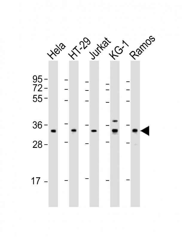 Rabbit Polyclonal Antibody to SPPL2B (N-Term)