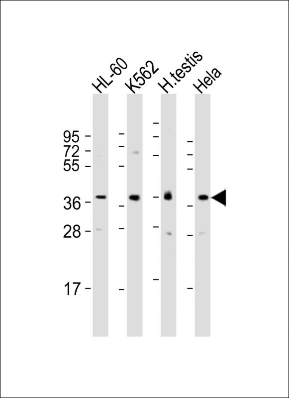 Rabbit Polyclonal Antibody to PRSS21 (N-Term)